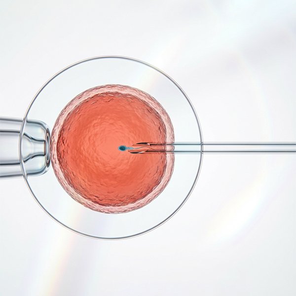 Fertilization & ICSI